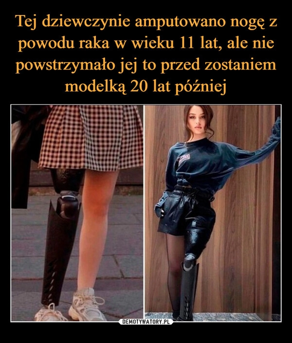 
    Tej dziewczynie amputowano nogę z powodu raka w wieku 11 lat, ale nie powstrzymało jej to przed zostaniem modelką 20 lat później