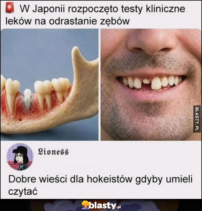 
    W Japonii rozpoczęto testy kliniczne leków na odrastanie zębów, dobre wieści dla hokeistów gdyby umieli czytać