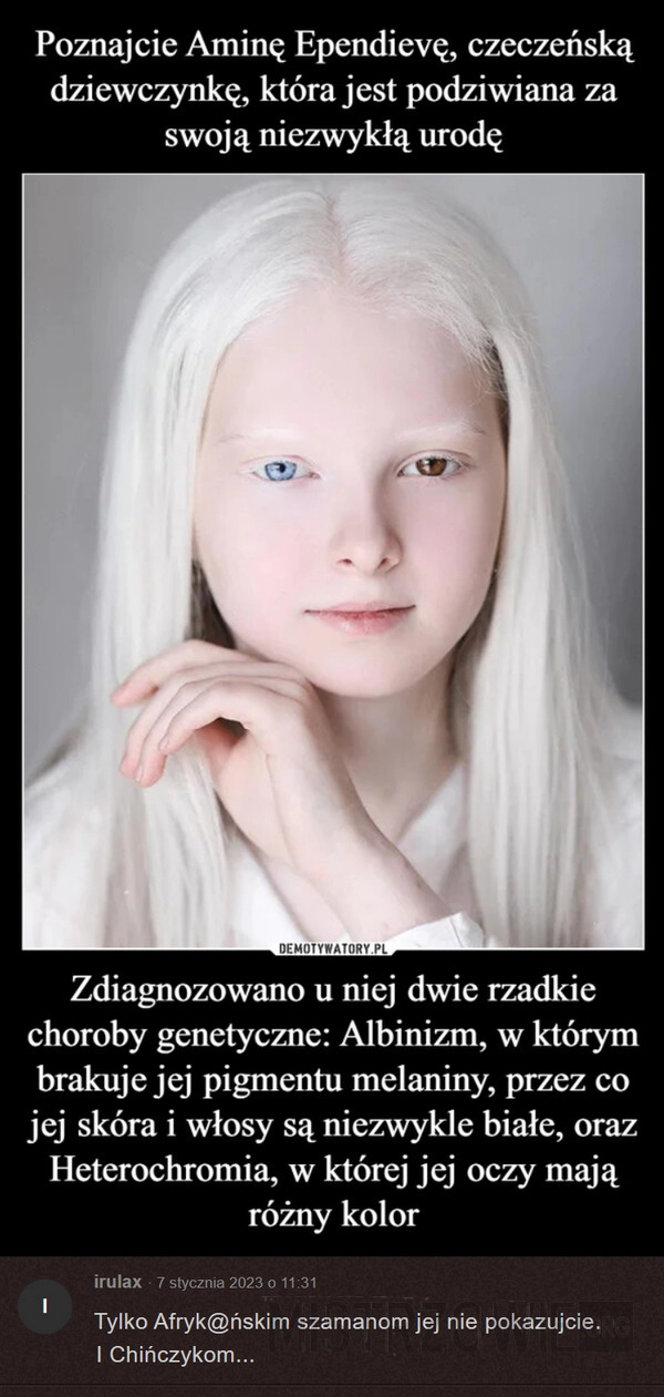 
    Niezwykła uroda