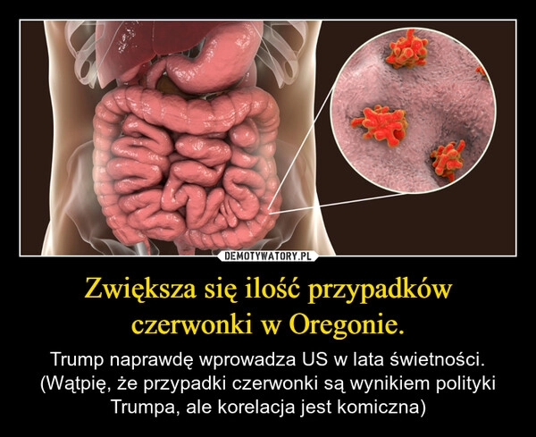 
    Zwiększa się ilość przypadków czerwonki w Oregonie.