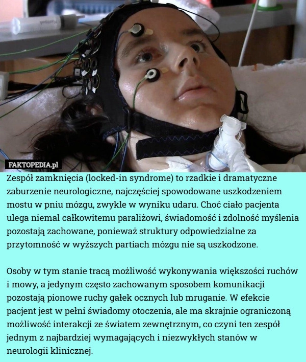 
    Zespół zamknięcia (locked-in syndrome) to rzadkie i dramatyczne zaburzenie