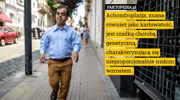 
    Achondroplazja, znana również jako karłowatość, jest rzadką chorobą genetyczną,