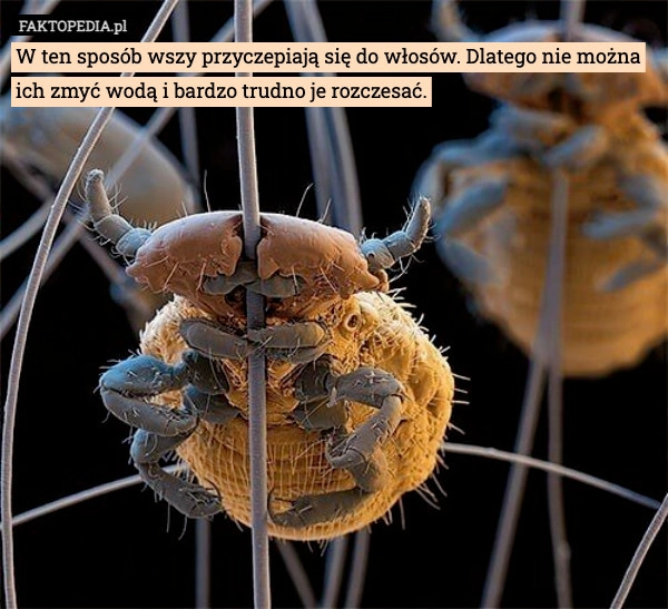 
    W ten sposób wszy przyczepiają się do włosów. Dlatego nie można ich zmyć
