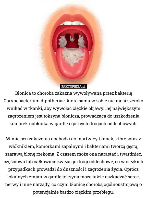 
    Błonica to choroba zakaźna wywoływana przez bakterię Corynebacterium diphtheriae,