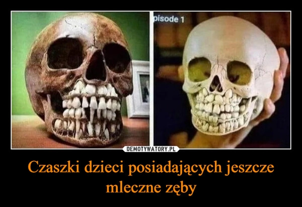 
    Czaszki dzieci posiadających jeszcze mleczne zęby