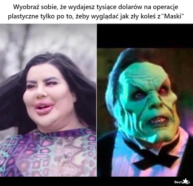 
    Operacje plastyczne 