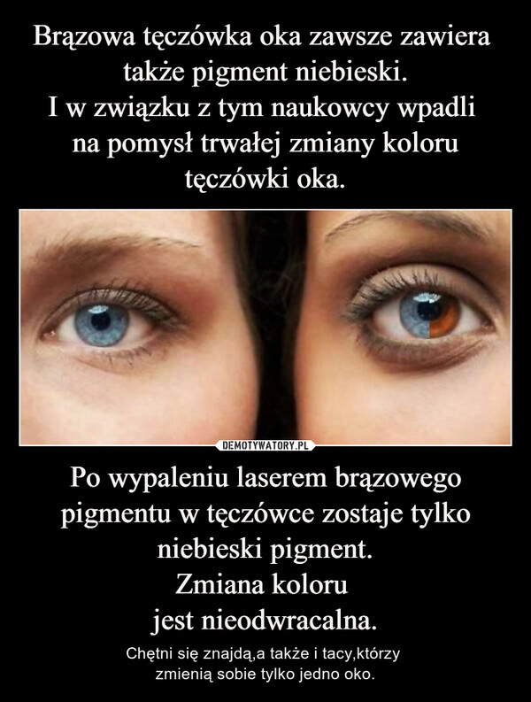 
    Brązowa tęczówka oka zawsze zawiera  także pigment niebieski.
I w związku z tym naukowcy wpadli 
na pomysł trwałej zmiany koloru tęczówki oka. Po wypaleniu laserem brązowego pigmentu w tęczówce zostaje tylko niebieski pigment.
Zmiana koloru 
jest nieodwracalna.