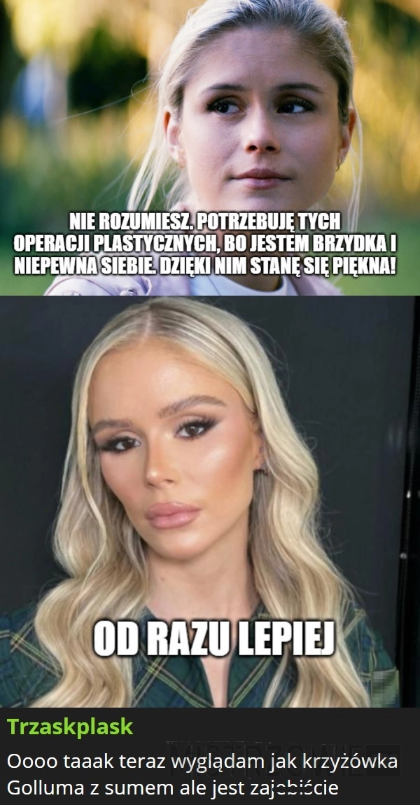 
    Operacje plastyczne