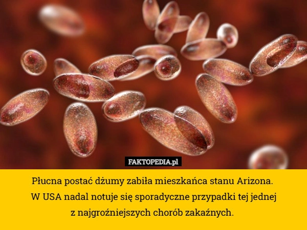 
    Płucna postać dżumy zabiła mieszkańca stanu Arizona. 
W USA nadal notuje
