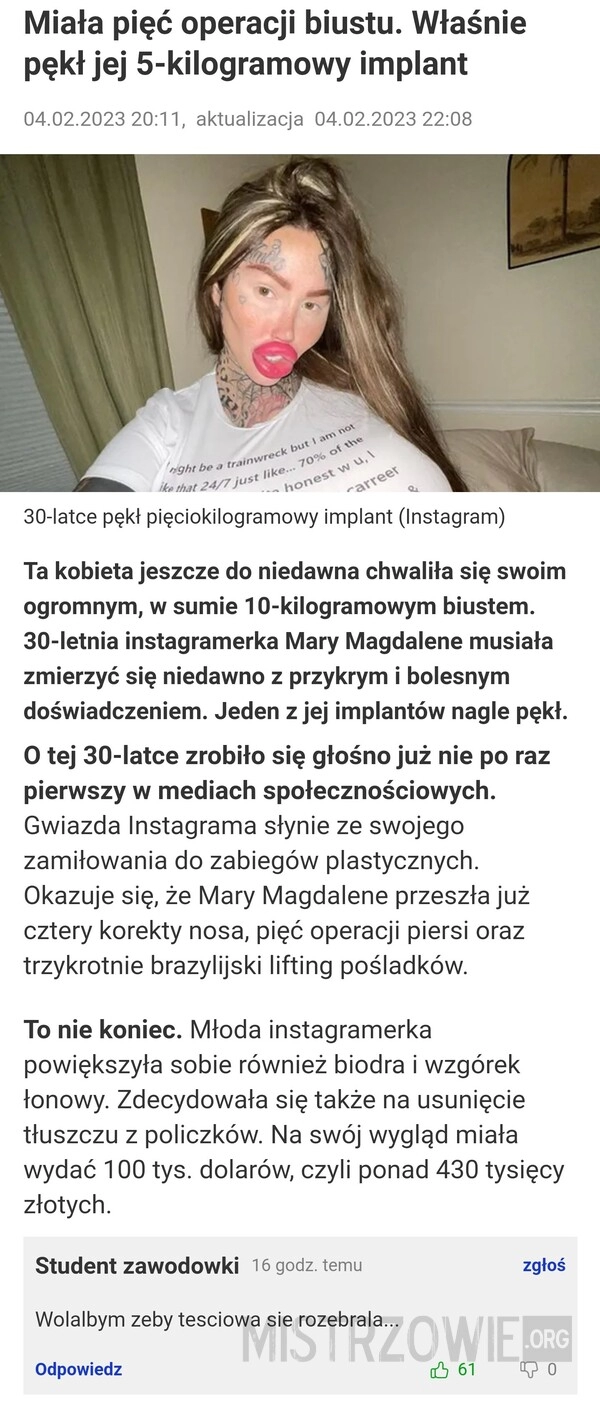 
    Operacje plastyczne