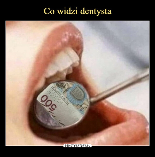 
    Co widzi dentysta