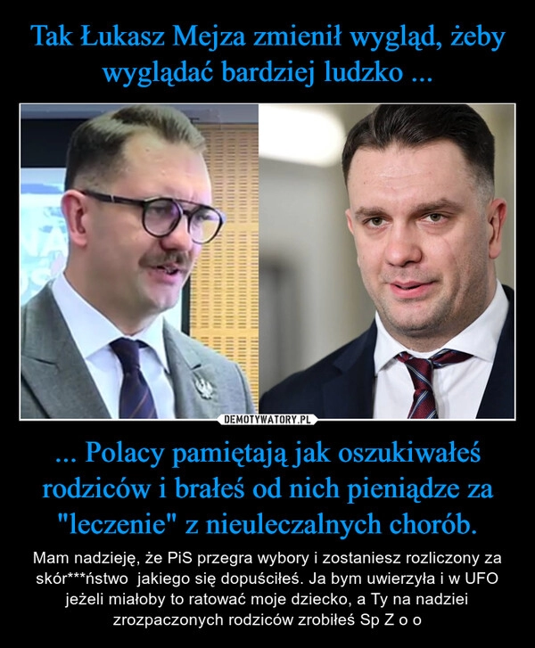 
    Tak Łukasz Mejza zmienił wygląd, żeby wyglądać bardziej ludzko ... ... Polacy pamiętają jak oszukiwałeś rodziców i brałeś od nich pieniądze za "leczenie" z nieuleczalnych chorób.