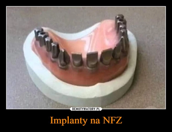 
    Implanty na NFZ