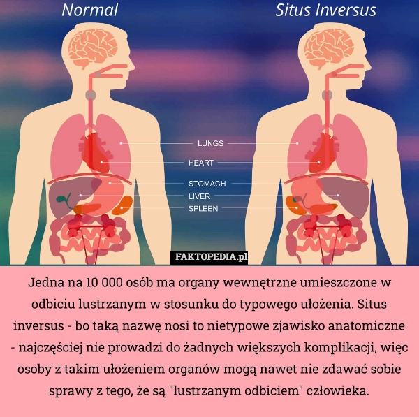 
    Jedna na 10 000 osób ma organy wewnętrzne umieszczone w odbiciu lustrzanym