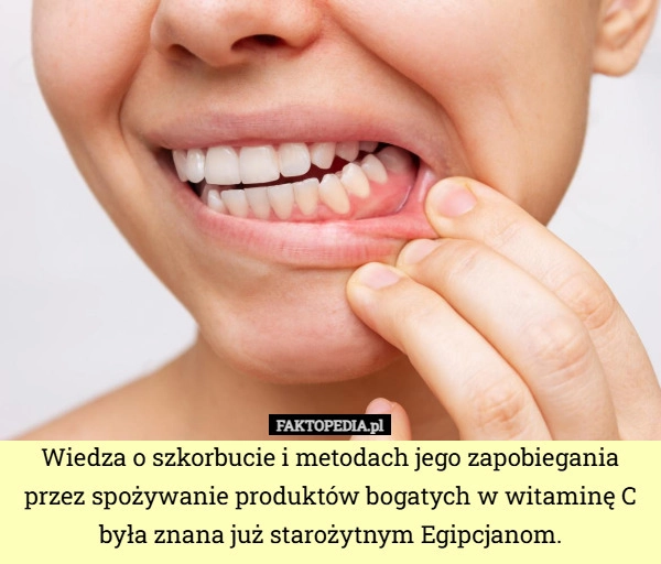 
    Wiedza o szkorbucie i metodach jego zapobiegania przez spożywanie produktów