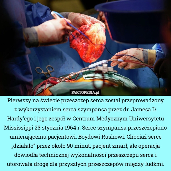 
    Pierwszy na świecie przeszczep serca został przeprowadzony
z wykorzystaniem