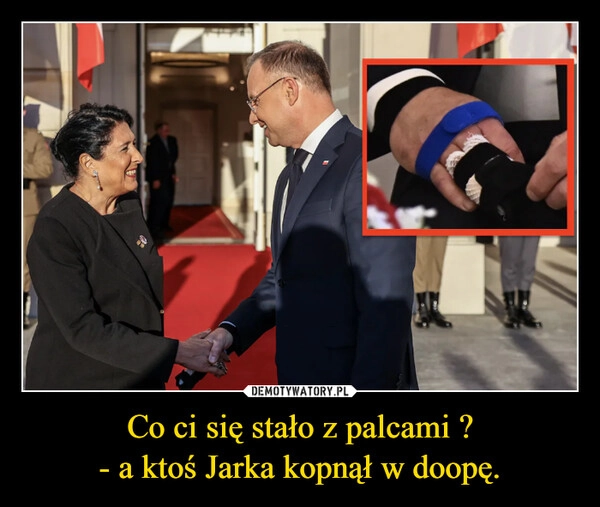 
    Co ci się stało z palcami ?
- a ktoś Jarka kopnął w doopę.