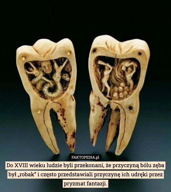 
    Do XVIII wieku ludzie byli przekonani, że przyczyną bólu zęba był „robak”