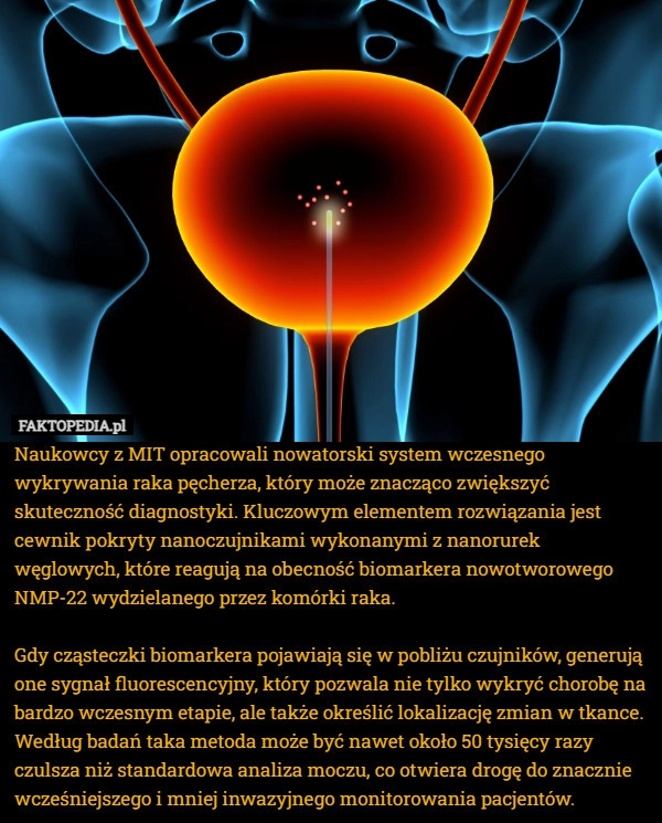 
    Naukowcy z MIT opracowali nowatorski system wczesnego wykrywania raka pęcherza,