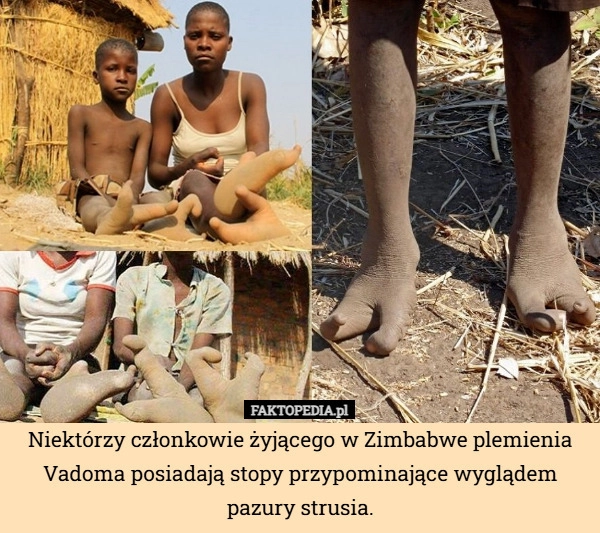
    Niektórzy członkowie żyjącego w Zimbabwe plemienia Vadoma posiadają stopy