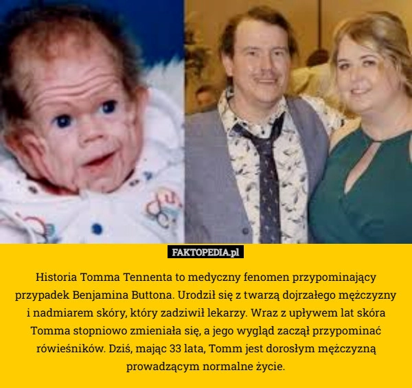 
    Historia Tomma Tennenta to medyczny fenomen przypominający przypadek Benjamina
