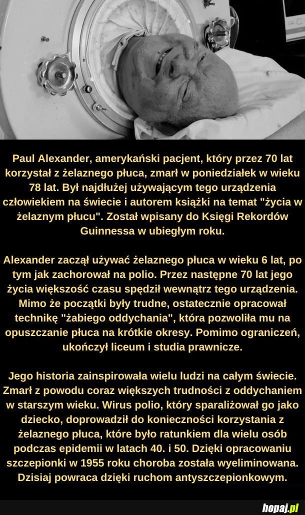 
    Zmarł człowiek z żelaznego płuca.