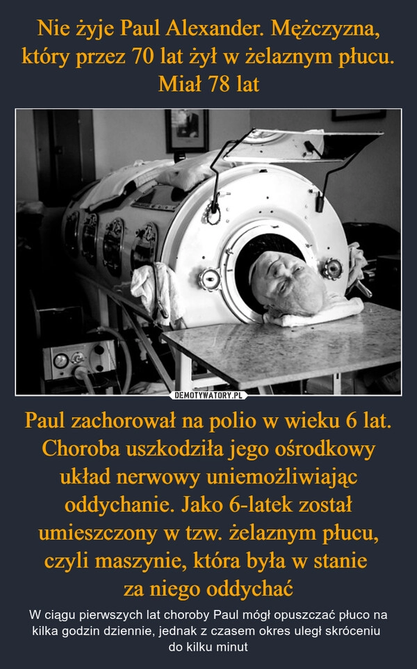 
    Nie żyje Paul Alexander. Mężczyzna, który przez 70 lat żył w żelaznym płucu. Miał 78 lat Paul zachorował na polio w wieku 6 lat. Choroba uszkodziła jego ośrodkowy układ nerwowy uniemożliwiając oddychanie. Jako 6-latek został umieszczony w tzw. żelaznym płucu, czyli maszynie, która była w stanie 
za niego oddychać