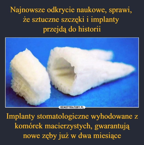 
    Najnowsze odkrycie naukowe, sprawi, 
że sztuczne szczęki i implanty 
przejdą do historii Implanty stomatologiczne wyhodowane z komórek macierzystych, gwarantują nowe zęby już w dwa miesiące