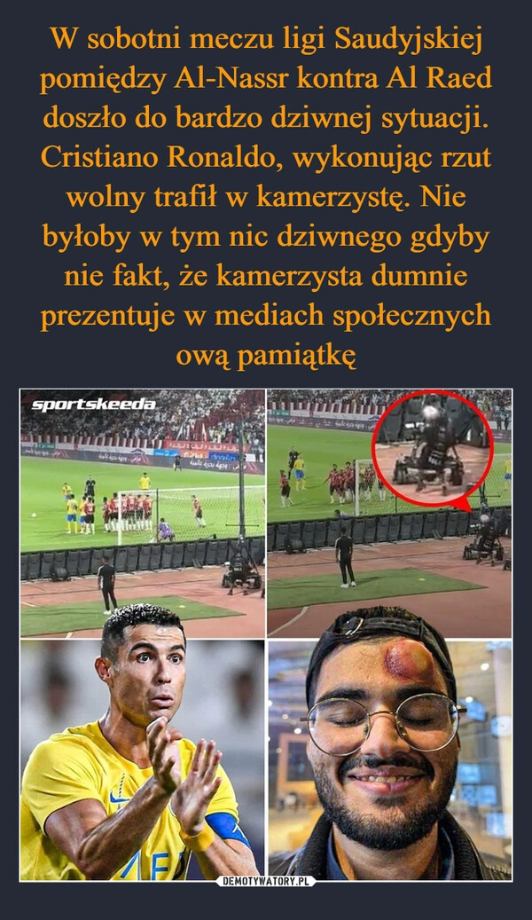 
    W sobotni meczu ligi Saudyjskiej pomiędzy Al-Nassr kontra Al Raed doszło do bardzo dziwnej sytuacji. Cristiano Ronaldo, wykonując rzut wolny trafił w kamerzystę. Nie byłoby w tym nic dziwnego gdyby nie fakt, że kamerzysta dumnie prezentuje w mediach społecznych ową pamiątkę