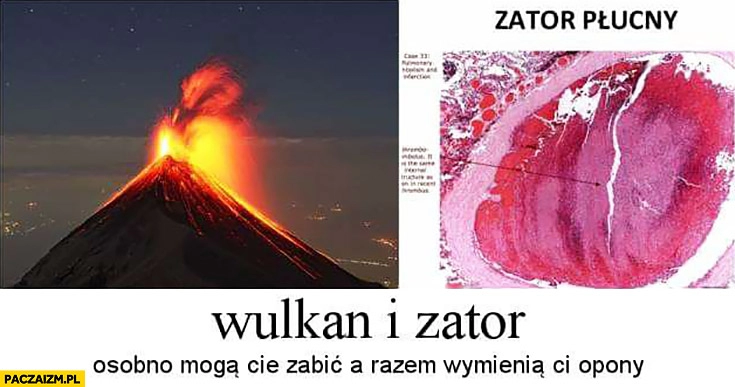 
    Wulkan i zator osobno mogą Cię zabić a razem wymienia ci opony