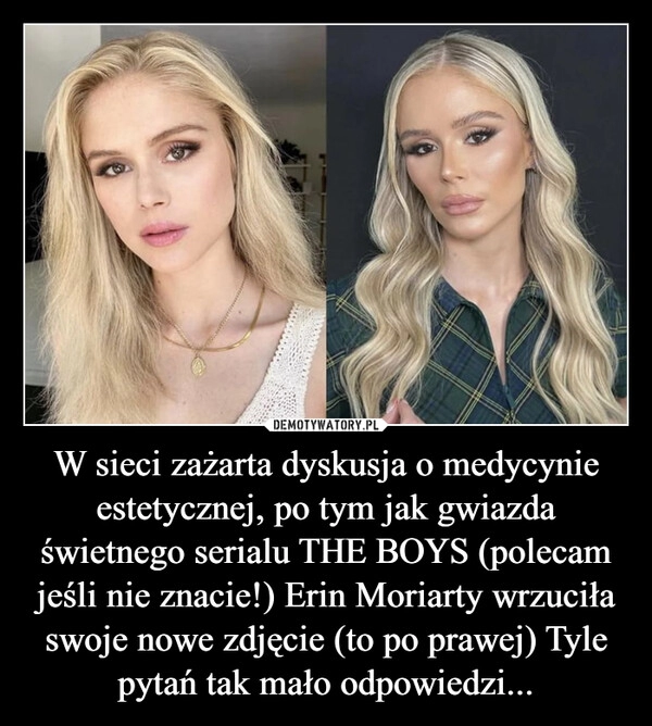 
    W sieci zażarta dyskusja o medycynie estetycznej, po tym jak gwiazda świetnego serialu THE BOYS (polecam jeśli nie znacie!) Erin Moriarty wrzuciła swoje nowe zdjęcie (to po prawej) Tyle pytań tak mało odpowiedzi...