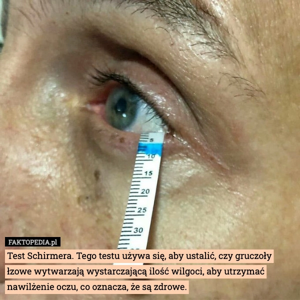 Test Schirmera. Tego testu używa się, aby ustalić, czy gruczoły łzowe wytwarzają