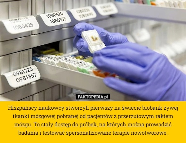 
    Hiszpańscy naukowcy stworzyli pierwszy na świecie biobank żywej tkanki mózgowej