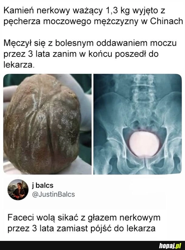
    Poczekajmy, może samo przejdzie