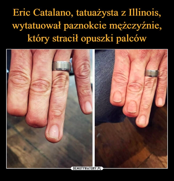 
    Eric Catalano, tatuażysta z Illinois, wytatuował paznokcie mężczyźnie, który stracił opuszki palców