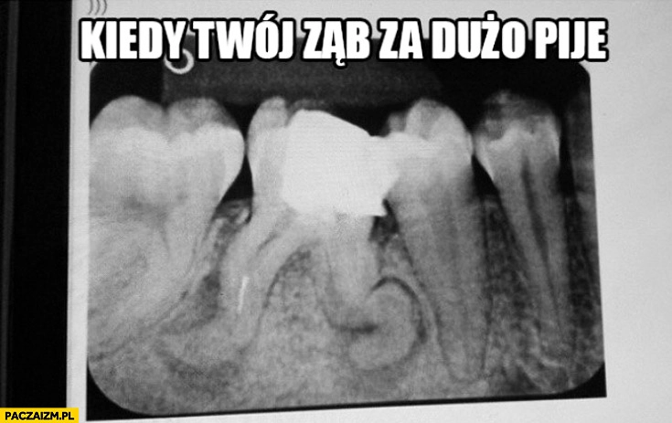 
    Kiedy Twój ząb za dużo pije