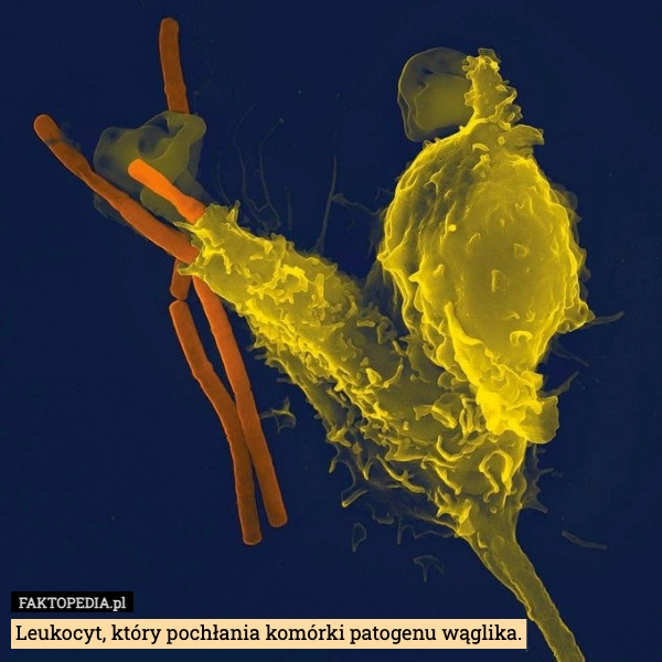 
    Leukocyt, który pochłania komórki patogenu wąglika.