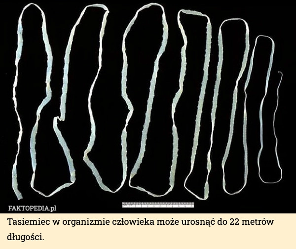 
    Tasiemiec w organizmie człowieka może urosnąć do 22 metrów długości.