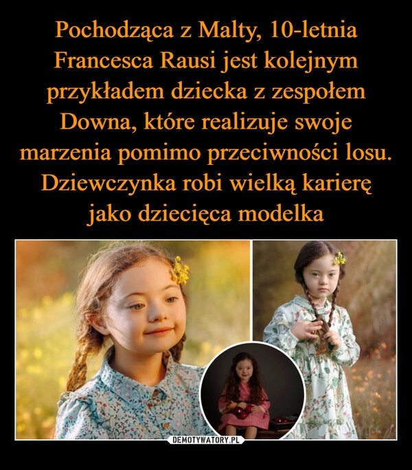 
    Pochodząca z Malty, 10-letnia Francesca Rausi jest kolejnym przykładem dziecka z zespołem Downa, które realizuje swoje marzenia pomimo przeciwności losu. Dziewczynka robi wielką karierę jako dziecięca modelka