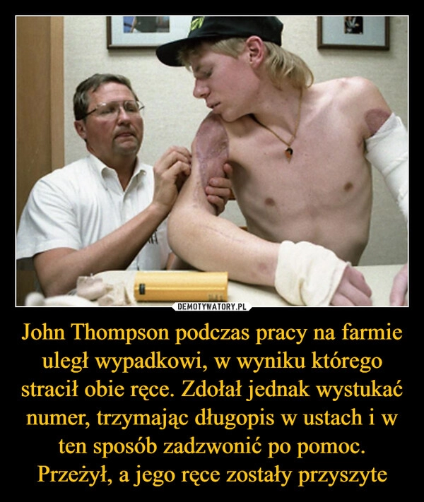 
    John Thompson podczas pracy na farmie uległ wypadkowi, w wyniku którego stracił obie ręce. Zdołał jednak wystukać numer, trzymając długopis w ustach i w ten sposób zadzwonić po pomoc. Przeżył, a jego ręce zostały przyszyte