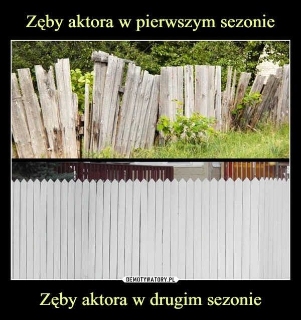 
    Zęby aktora w pierwszym sezonie Zęby aktora w drugim sezonie