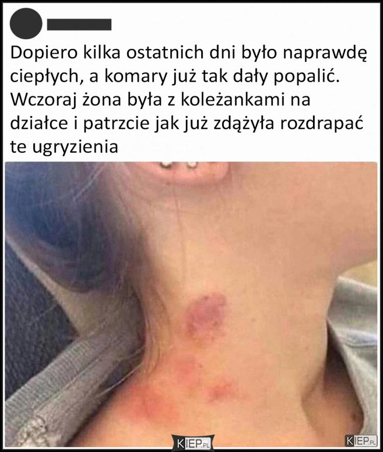 
    Ugryzienie po komarze