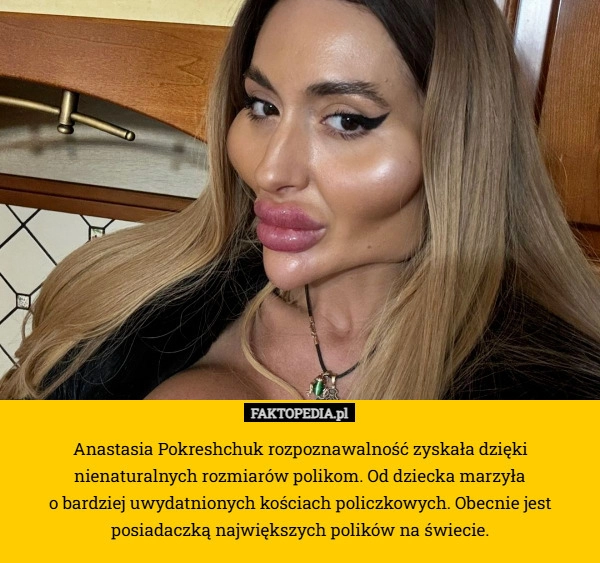 
    Anastasia Pokreshchuk rozpoznawalność zyskała dzięki nienaturalnych rozmiarów