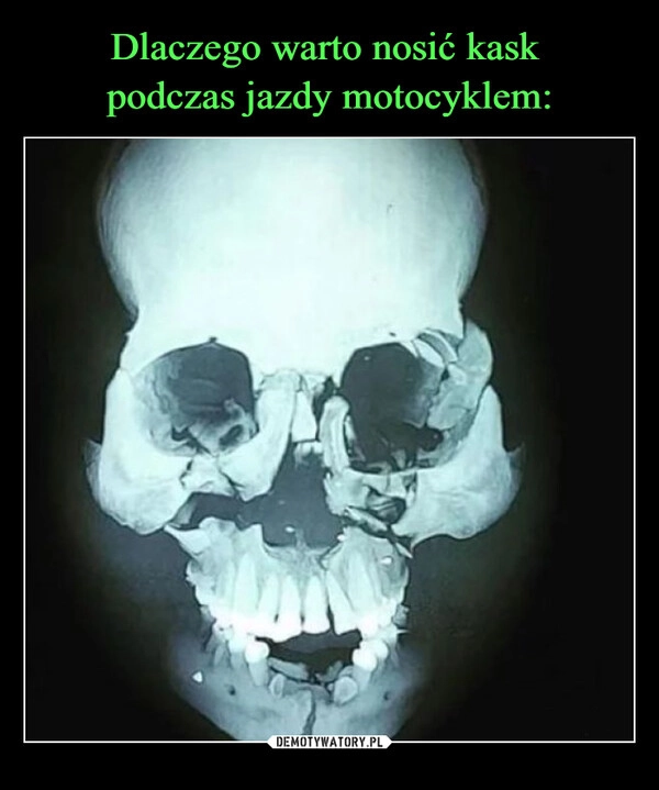 
    Dlaczego warto nosić kask 
podczas jazdy motocyklem: