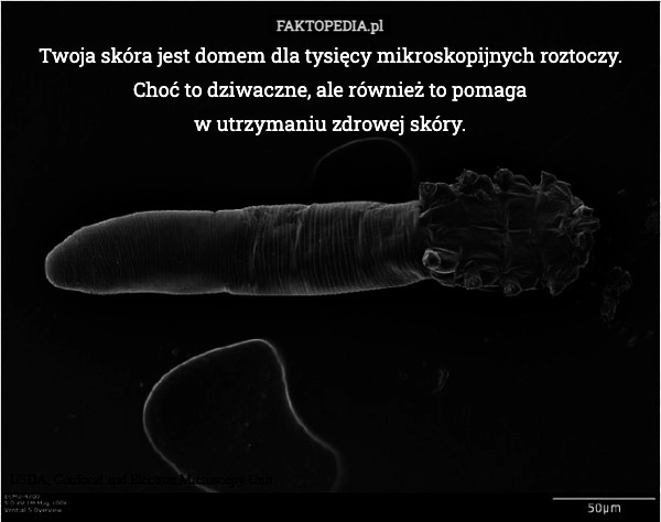 
    Twoja skóra jest domem dla tysięcy mikroskopijnych roztoczy. Choć to dziwaczne,