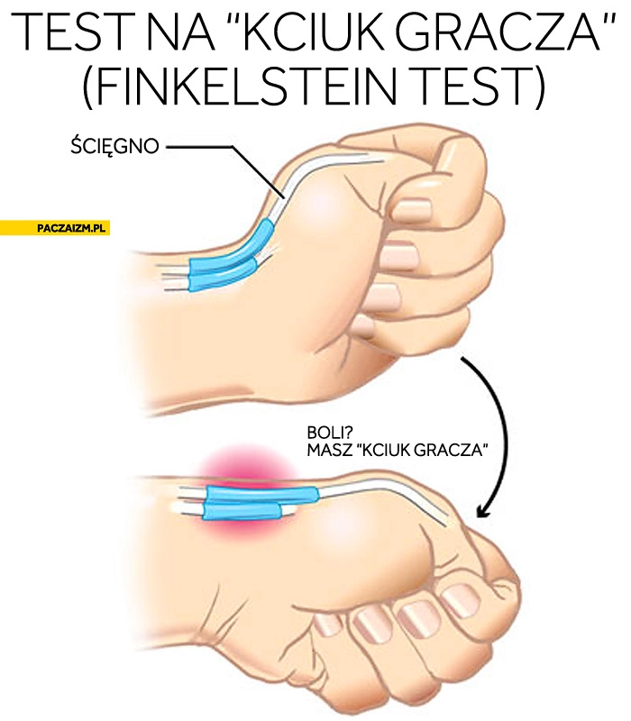 
    Test na kciuk gracza Finkelstein test