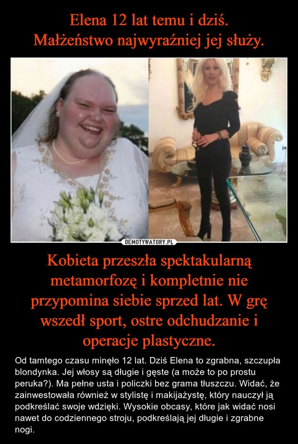 
    Elena 12 lat temu i dziś.
Małżeństwo najwyraźniej jej służy. Kobieta przeszła spektakularną metamorfozę i kompletnie nie przypomina siebie sprzed lat. W grę wszedł sport, ostre odchudzanie i operacje plastyczne. 