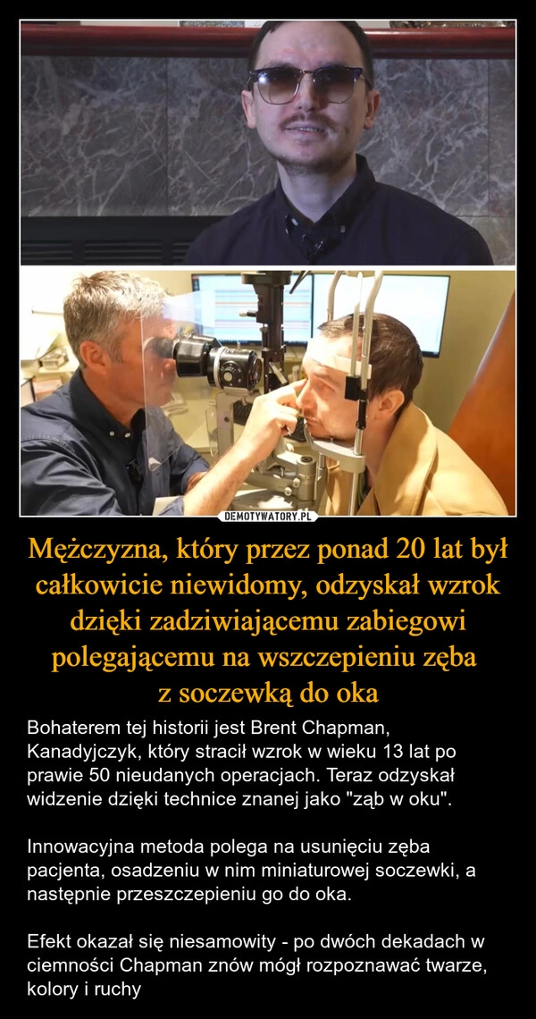 
    Mężczyzna, który przez ponad 20 lat był całkowicie niewidomy, odzyskał wzrok dzięki zadziwiającemu zabiegowi polegającemu na wszczepieniu zęba 
z soczewką do oka