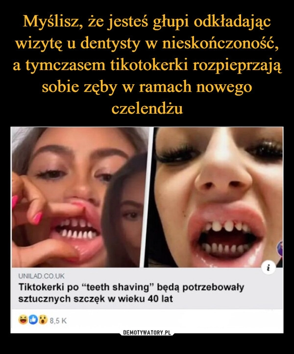 
    Myślisz, że jesteś głupi odkładając wizytę u dentysty w nieskończoność, a tymczasem tikotokerki rozpieprzają sobie zęby w ramach nowego czelendżu 